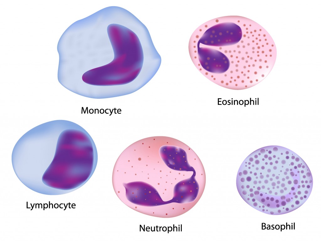 rasio-alc-amc-sebagai-biomarka-imun-prognostik-pada-multiple-myeloma